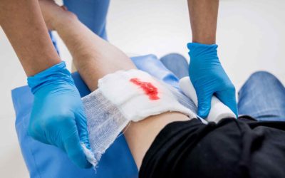 Boron in Wound Care