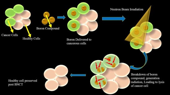 Boron Neutron Capture Therapy 3